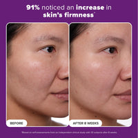Thumbnail for Paula's Choice CLINICAL 1% Retinol Face Treatment with Peptides, Vitamin C & Licorice Extract, Anti-Aging Skin Care Serum, Fine Lines & Wrinkles, Fragrance Free, 1 Fl Oz
