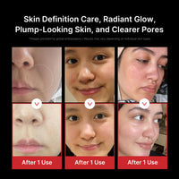 Thumbnail for medicube Booster Pro | 6-in-1 Real Glass Glow Beauty Massager | for Clear, Radiant, Firmer-Looking Skin | Korean Skin Care | Black
