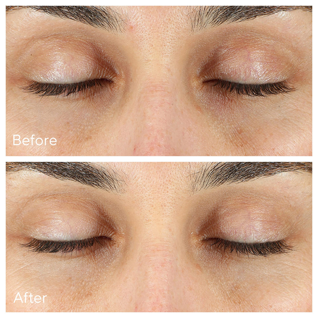 Murad Vita-C Eyes Dark Circle Corrector – Environmental Shield Vitamin C Brightening Serum – Anti-Aging Treatment for Puffiness and Wrinkles, 0.5 Fl Oz