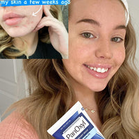 Thumbnail for PanOxyl 4 Acne Creamy Wash, 4% Benzoyl Peroxide 6 oz (Pack of 4)