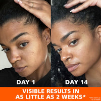 Thumbnail for Palmer's Skin Success Anti-Dark Spot Fade Cream with Vitamin E and Niacinamide, for All Skin Types 2.7 Ounce