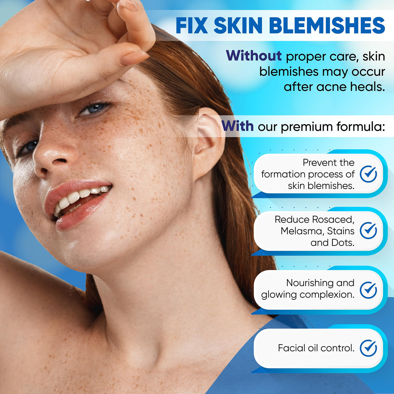 AOBBIY Azelaic Acid Cream for Face: Redness-Soothing Azelaic Acid Facial Cream for Uneven Tone, Blemish-Prone Skin, Pore Care, and Skin Clarity Support, 4 oz