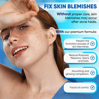 Thumbnail for AOBBIY Azelaic Acid Cream for Face: Redness-Soothing Azelaic Acid Facial Cream for Uneven Tone, Blemish-Prone Skin, Pore Care, and Skin Clarity Support, 4 oz