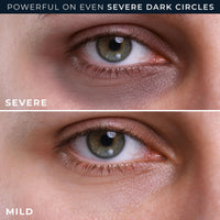 Thumbnail for RoC Derm Correxion Retinol Eye Repair Dark Circle Cream Treatment with Niacinamide, Resveratrol, Proxygen for puffy eyes, wrinkles, and crow's feet with Line Smoothing Eye Packette