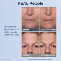 Thumbnail for Plexaderm Rapid Reduction Eye Serum - Visibly Reduces Under-Eye Bags, Wrinkles, Dark Circles, Fine Lines & Crow's Feet Instantly, Anti Aging Wrinkle Remover for Face, Full Size Tube