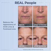 Thumbnail for Plexaderm Rapid Reduction Eye Serum - Visibly Reduces Under-Eye Bags, Wrinkles, Dark Circles, Fine Lines & Crow's Feet Instantly, Anti Aging Wrinkle Remover for Face, Full Size Tube