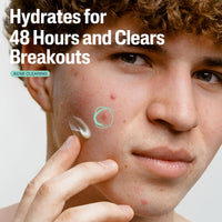 Thumbnail for Cetaphil Face Moisturizer, Gentle Clear Mattifying Acne Moisturizer With 0.5% Salicylic Acid, Hydrates and Treats Sensitive Acne Prone Skin, Skin Care for Sensitive Skin, 3oz