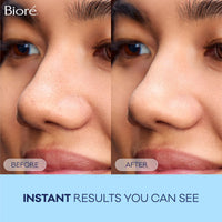 Thumbnail for Bioré Original Blackhead Remover Strips, Deep Cleansing Nose Strips With Instant Pore Unclogging, Features C-Bond Technology, Oil-Free, Non-Comedogenic Use, 14 Count