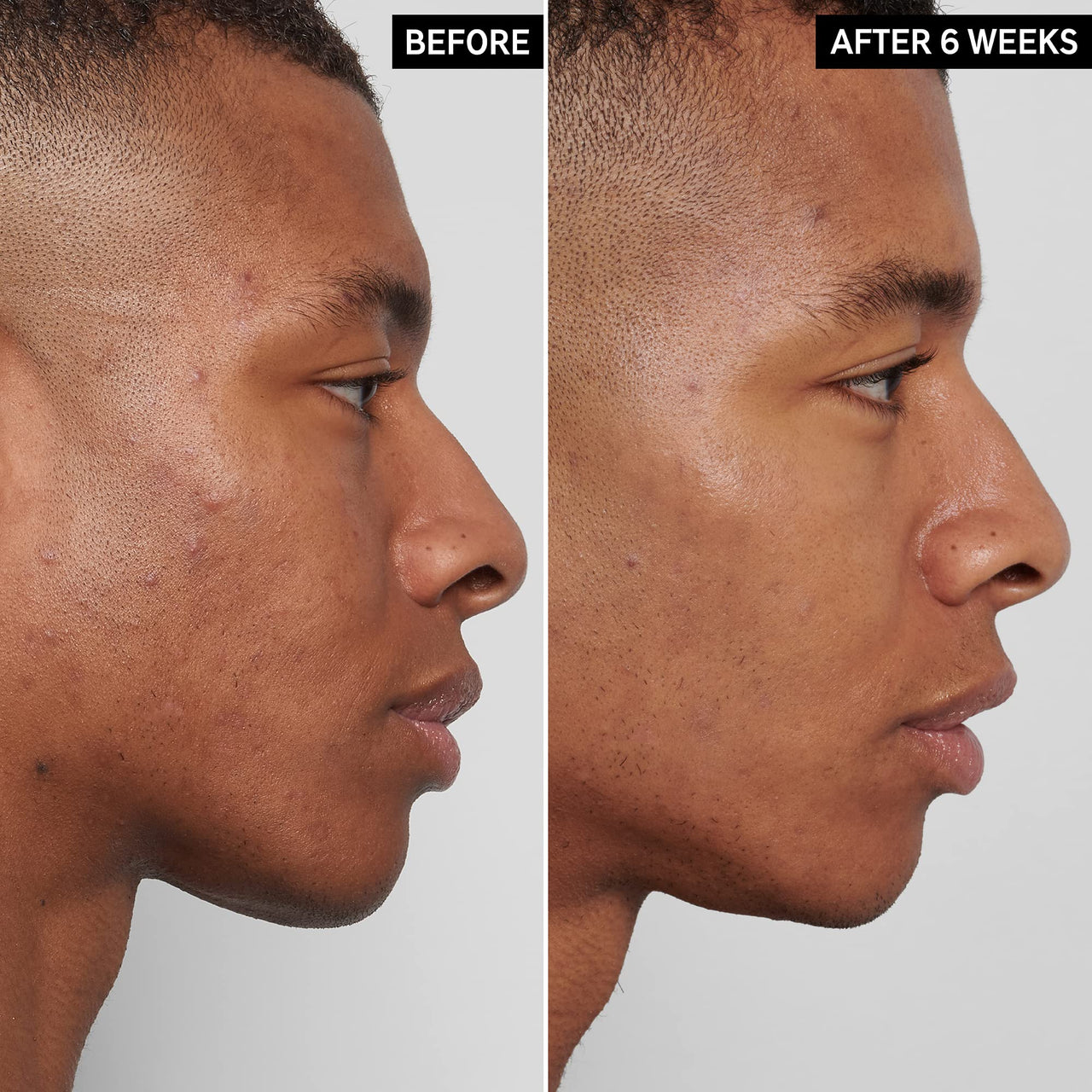 The INKEY List Mandelic Acid Treatment, .5 fl oz