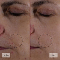 Thumbnail for philosophy hope in a jar skincare essentials mini set