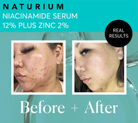 Thumbnail for Naturium Niacinamide Face Serum 12% Plus Zinc 2% Jumbo, Anti-Aging, Pore Minimizer & Dark Spot Corrector with Hyaluronic Acid & Vitamin E, Vegan & Cruelty-Free, 2 oz