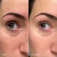 Thumbnail for Topicals Faded Brightening Under Eye Masks | Patches to Depuff, Hydrate, Brighten and Cool | Reduce Dark Circles and Fine Lines | Contains Kojic Acid, Caffeine and Niacinamide (Set of 6)