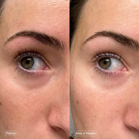 Thumbnail for Topicals Faded Brightening Under Eye Masks | Patches to Depuff, Hydrate, Brighten and Cool | Reduce Dark Circles and Fine Lines | Contains Kojic Acid, Caffeine and Niacinamide (Set of 6)