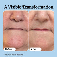 Thumbnail for Vibriance Super C Serum for Mature Skin - All-in-One Vitamin Formula Hydrates, Firms, Lifts, Smooths, Targets Age Spots, Wrinkles, 1 fl oz