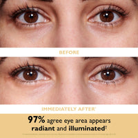 Thumbnail for Peter Thomas Roth | 24K Gold Firming Hydra-Gel Eye Patches | Gold-Infused Eye Mask Patches for Fine Lines, Crow's Feet and Dark Circles