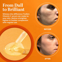 Thumbnail for TruSkin Vitamin C Anti Aging Facial Serum for Dark Spots, Even Skin Tone, Eye Area, Fine Lines & Wrinkles