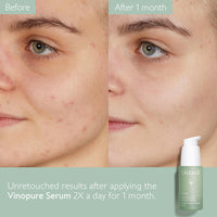 Thumbnail for Caudalie Vinopure Natural Salicylic Acid Pore Minimizing Serum with Niacinamide, Skin Perfecting Serum - 30 mL