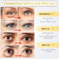 Thumbnail for NAZANO 24K Gold Under Eye Patches - 60 Pack for Puffy Eyes, Dark Circles, Bags & Wrinkles with Collagen & Hyaluronic Acid - Eye Care Pads for Daily Skincare (Gold)