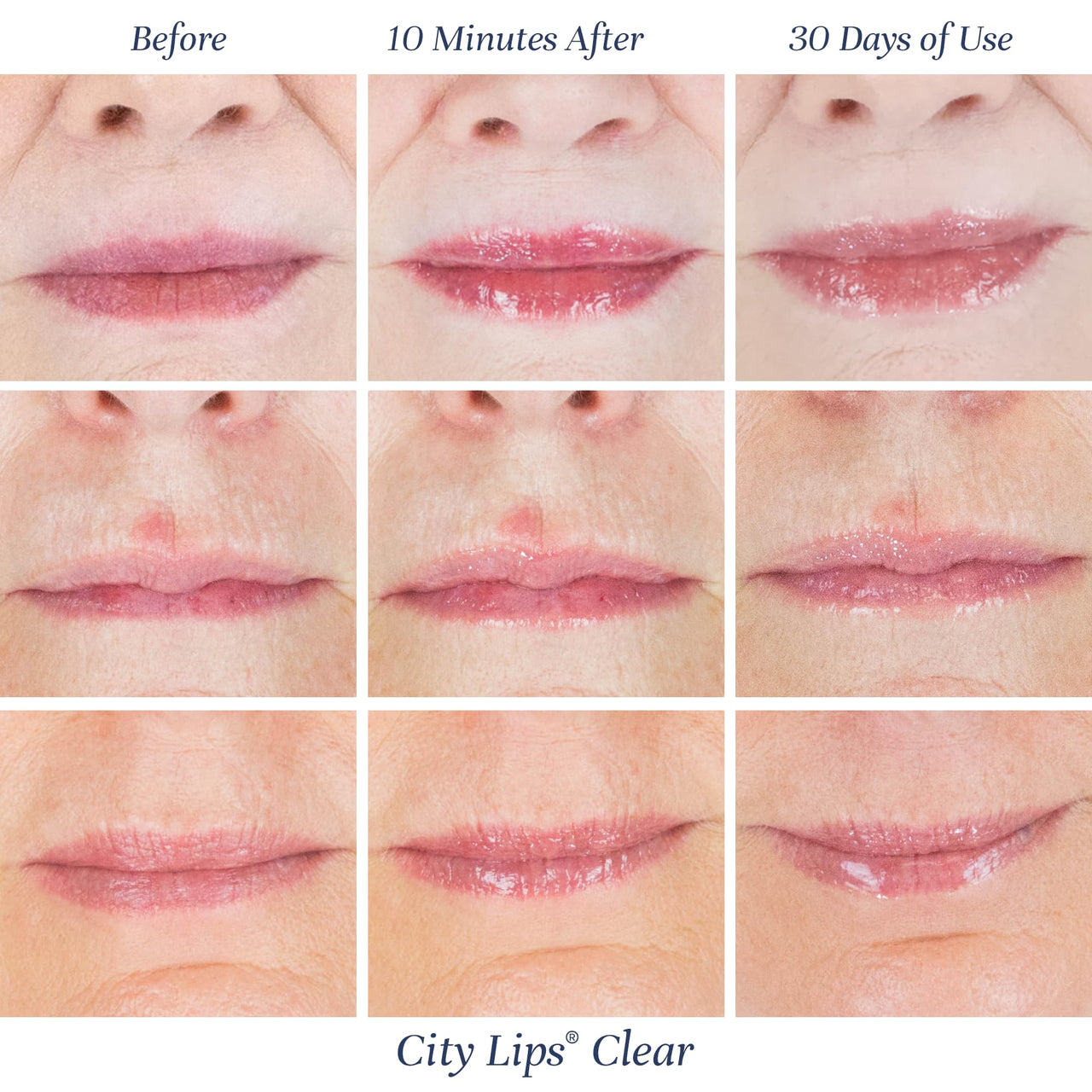 City Beauty City Lips Clear - Plumping Lip Gloss - Hydrate & Volumize - High Shine Lip Plumper - Hyaluronic Acid & Peptides Visibly Smooth Lip Wrinkles - Cruelty-Free (Clear, Pack of 1)