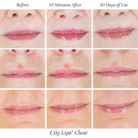 Thumbnail for City Beauty City Lips Clear - Plumping Lip Gloss - Hydrate & Volumize - High Shine Lip Plumper - Hyaluronic Acid & Peptides Visibly Smooth Lip Wrinkles - Cruelty-Free (Clear, Pack of 1)
