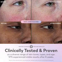 Thumbnail for Olay Super Serum - Glow Serum for Face - Activated Niacinamide, Vitamin C & E, Collagen Peptide, AHA - 5-in-1 Benefits - Brightens, Hydrates, Smooths, Firms, Evens Tone, Proactive Anti-Aging, 1.0 Oz