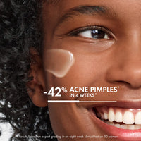 Thumbnail for VICHY Normaderm Acne Control Daily Moisturizer, Acne Moisturizer For Face, 2% Salicylic Acid + Hyaluronic Acid + Vitamin C, Acne Treatment For Blackheads, Acne Blemishes & Enlarged Pores, Oil Free