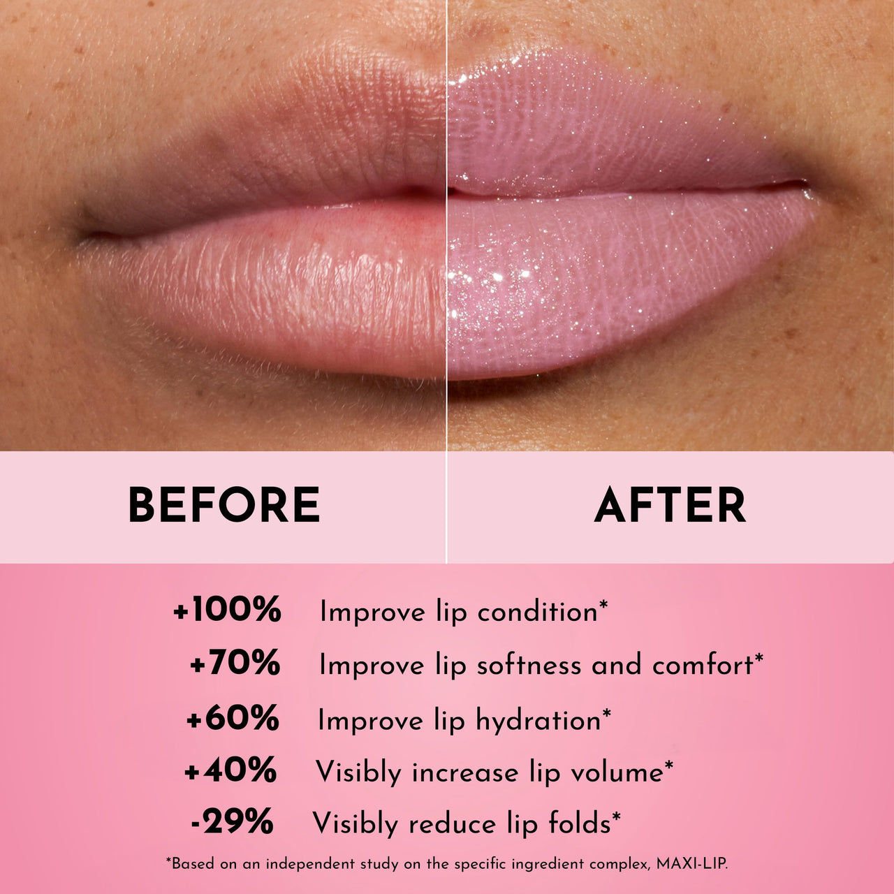 Lawless Forget the Filler Lip Plumping Line Smoothing Gloss - Daisy Girl - Premium Volumizing Lip Gloss with Natural Ingredients Designed to Plump, Firm, and Hydrate Lips 0.11 oz