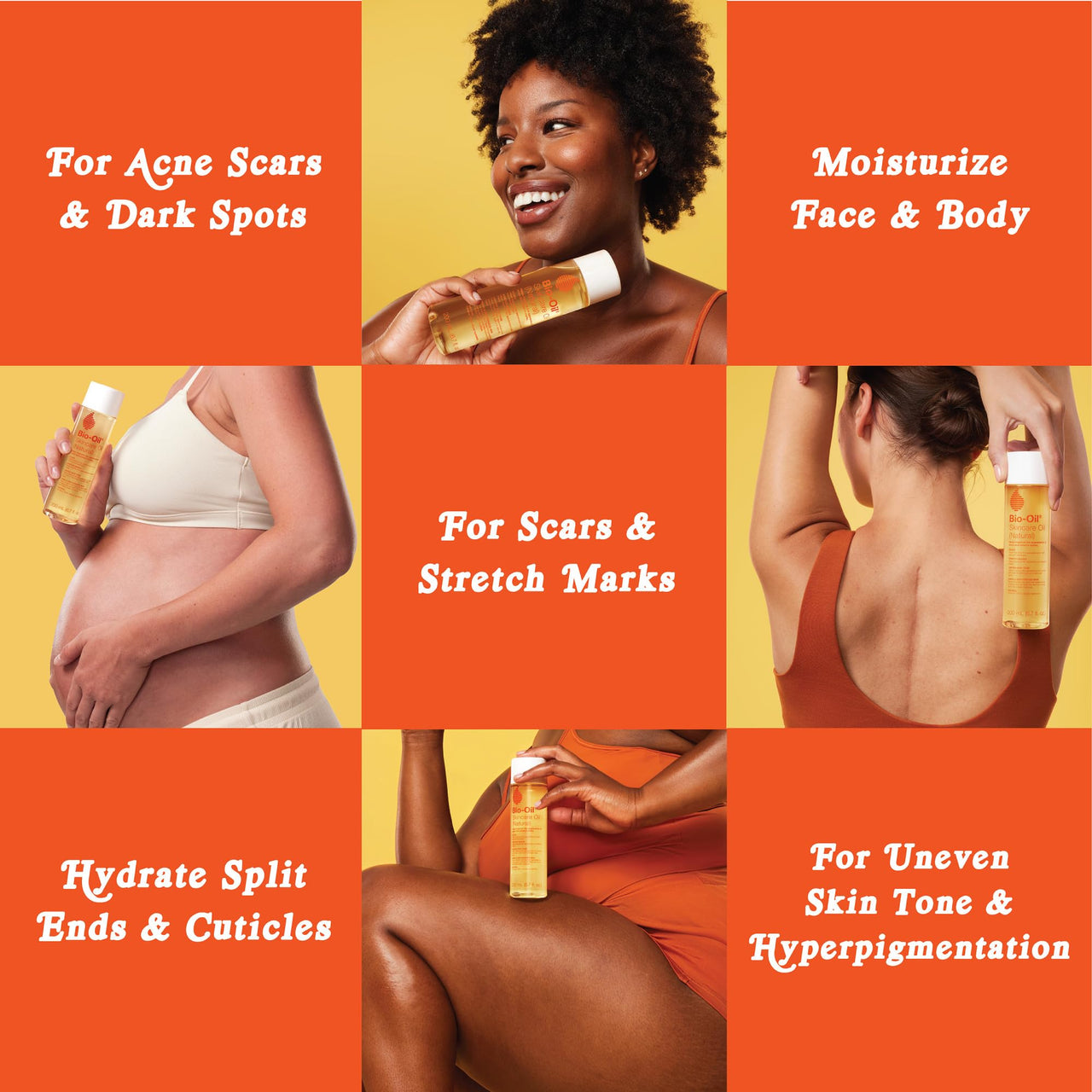 Bio-Oil Natural Skincare Oil, Serum for Scars and Stretch Marks, Face and Body Moisturizer for Dry Skin, Hair Oil, For All Skin Types, 4.2 Oz