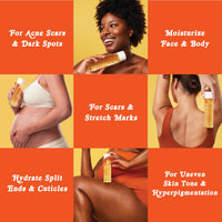 Thumbnail for Bio-Oil Natural Skincare Oil, Serum for Scars and Stretch Marks, Face and Body Moisturizer for Dry Skin, Hair Oil, For All Skin Types, 4.2 Oz