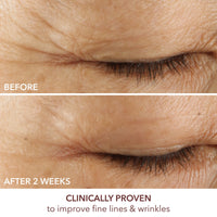 Thumbnail for Dr. Dennis Gross Advanced Retinol + Ferulic Eye Serum – Target Dark Circles, Puffiness, Fine Lines & Wrinkles for Smooth, Youthful-Looking Eyes, 0.5 oz