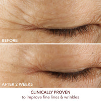Thumbnail for Advanced Retinol + Ferulic Triple Correction Eye Serum -15ml/0.5oz