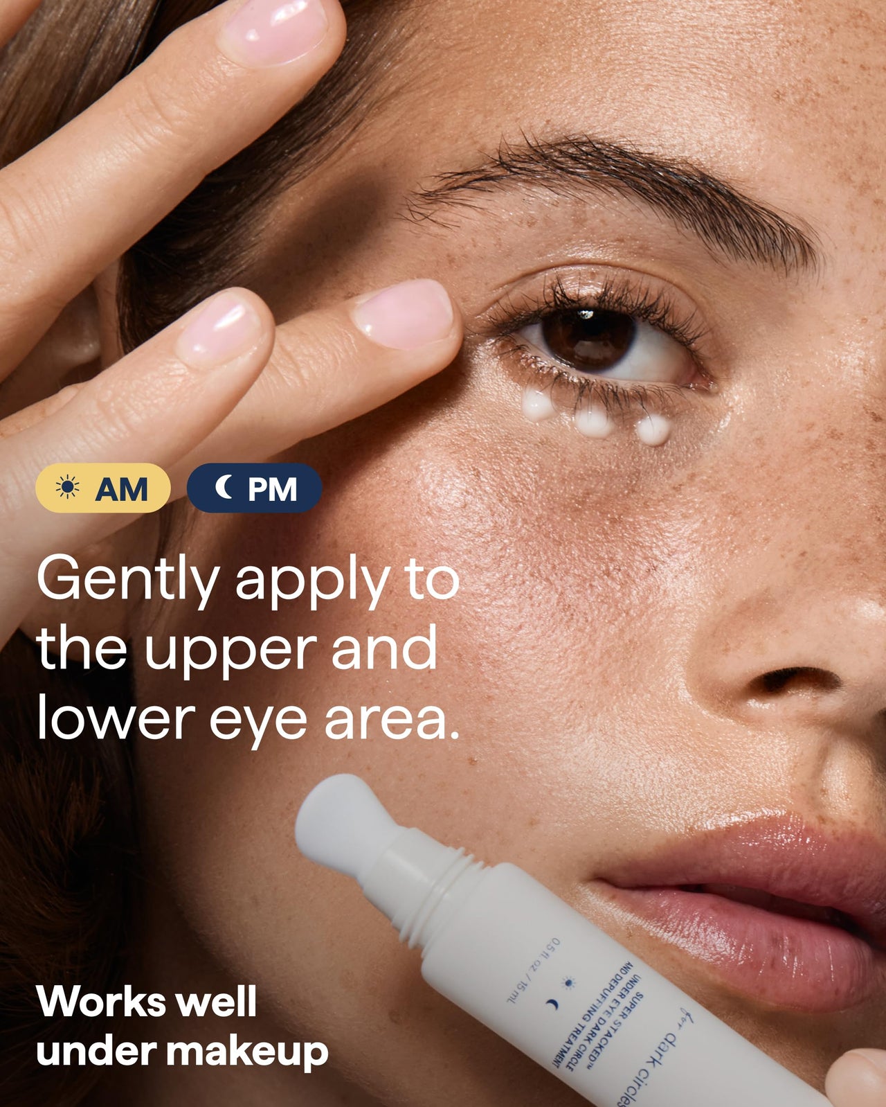 Remedy Dark Circles Reducing Advanced Eye Cream | Undereye Discoloration Treatment | Caffeine, Kojic Acid, Niacinamide, Marine Algae Complex | By Dermatologist Dr. Shah, 0.5 fl. Oz