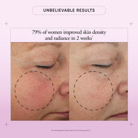 Thumbnail for philosophy ultimate miracle worker multi-rejuvenating face moisturizer cream + spf 30 - with encapsulated retinol - delivers firmer, youthful looking & radiant skin without irritation - 2 fl oz