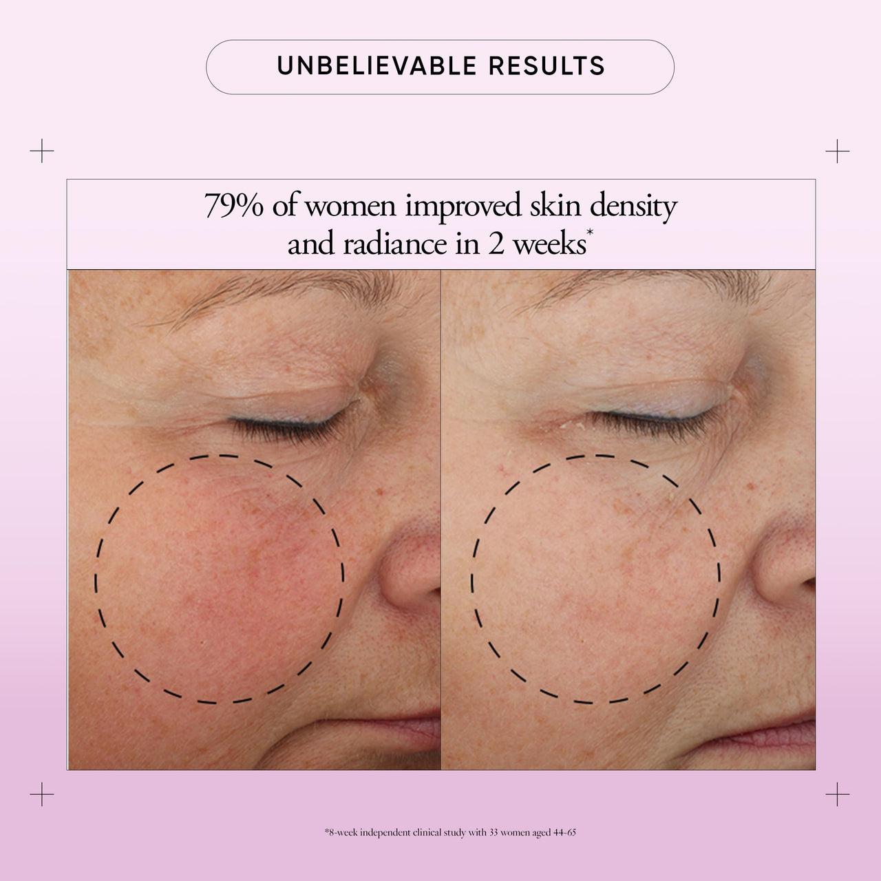 philosophy ultimate miracle worker multi-rejuvenating face moisturizer cream + spf 30 - with encapsulated retinol - delivers firmer, youthful looking & radiant skin without irritation - 2 fl oz