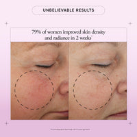 Thumbnail for philosophy ultimate miracle worker multi-rejuvenating face moisturizer cream + spf 30 - with encapsulated retinol - delivers firmer, youthful looking & radiant skin without irritation - 2 fl oz