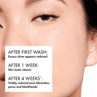 Thumbnail for VICHY Normaderm Daily Acne Face Wash, 0.5% Salicylic Acid Cleanser, Gel Cleanser For Oily Skin, Removes Excess Oil, Dirt & Clogged Pores, Oil Free Acne Wash, Soap & Sulfate Free, Non-Drying