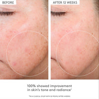 Thumbnail for Drunk Elephant C-Firma Fresh Day Serum - 28 ml/.94 fl oz - 15% Illuminating Vitamin C - Clean Clinical Skincare - Cruelty-Free - Dermatologist-Tested - Free of Essential Oils, Silicones, and Fragrance