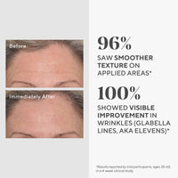 Thumbnail for Murad Targeted Wrinkle Corrector – Hyaluronic Acid and Peptide Anti-Aging Cream for Reducing Wrinkles, Instant Plumping, Smoothing, and Hydrating Fine Lines – 0.5 Oz
