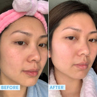 Thumbnail for Sand & Sky Hyaluronic Acid Serum for Face - Hydrating Serum with Probiotics & Fermented Sea Kelp, Fine Line Reducing Face Serum, Plumps Skin & Smooths Wrinkles, 1 fl oz