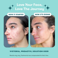 Thumbnail for Proactiv 3 Step Acne Treatment - Benzoyl Peroxide Face Wash, Repairing Acne Spot Treatment for Face and Body, Exfoliating Toner - 30 Day Complete Acne Skin Care Kit