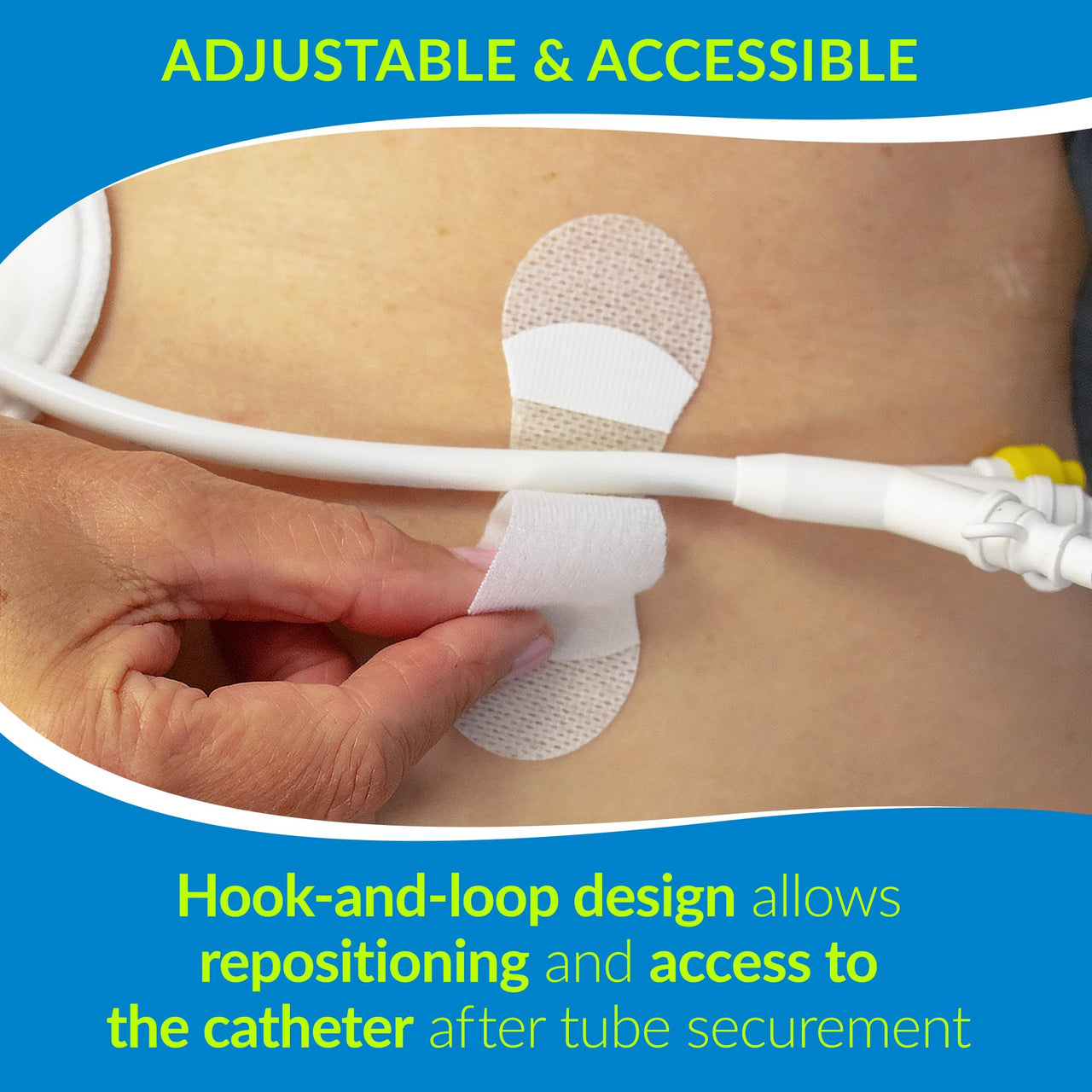 TIDI 3300M Grip-Lok Medium Securement Device ― Pack of 100 ― Catheter Stabilization Device ― White ― Flexible Material ― Low-Profile Design for Comfort― Home Healthcare ― Medical Supplies