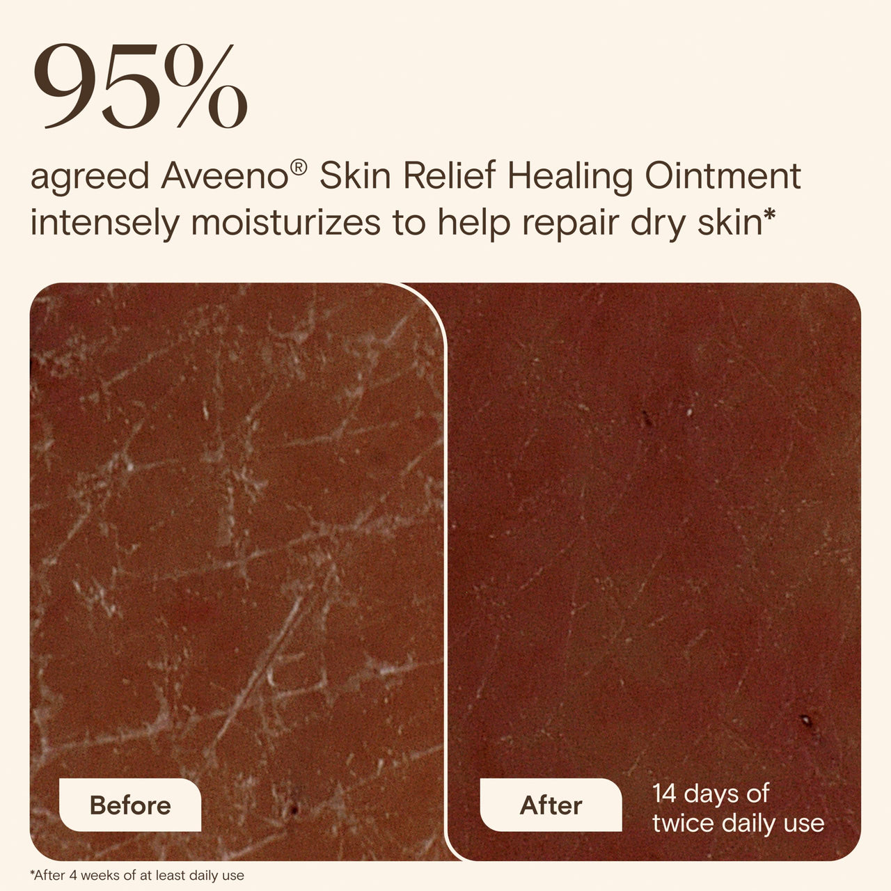 Aveeno Skin Relief Healing Ointment, for Extra Dry, Cracked & Sensitive Skin, 72-Hour Protectant with Triple Oat, Shea Butter & Glycerin, Fragrance-Free for Body, Face, Hands, Lips 7.2 oz