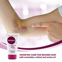 Thumbnail for Dermend Arnica Bruise Cream with Vitamin K - Moisturizer for Bruising on Arms, Legs & Hands - 4.5 Oz