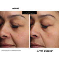 Thumbnail for Kate Somerville Mega-A Skin Transforming Serum – Anti-Aging Serum with Hyaluronic Acid For Uneven Texture and Wrinkles, 1 Fl. Oz