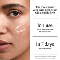 Thumbnail for Neutrogena Evenly Clear Acne Gel Moisturizer with Salicylic Acid & N-Acetyl Glucosamine, Lightweight Non-Greasy Face Moisturizer Helps Treat Breakouts & Visibly Fade the look of Post-Acne, 1.7 fl. oz