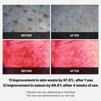 Thumbnail for Medicube Red Succinic Acid Panthenol Facial Peeling Pads - Exfoliating Toner Pads for Breakout-Prone Skin with Niacinamide, AHA, BHA, and Soothing Panthenol - Non-Comedogenic