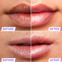 Thumbnail for Wonderskin Lip Oil - Lip Rehab Serum Oil, Hydrating and Moisturizing Clear Serum for Dry Lips - Natural, Vegan and Non-sticky (Clear)