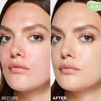 Thumbnail for L'Oréal Paris Makeup Magic Skin Beautifier BB Cream Tinted Moisturizer, Anti-Redness, 1 fl oz, 1 Count