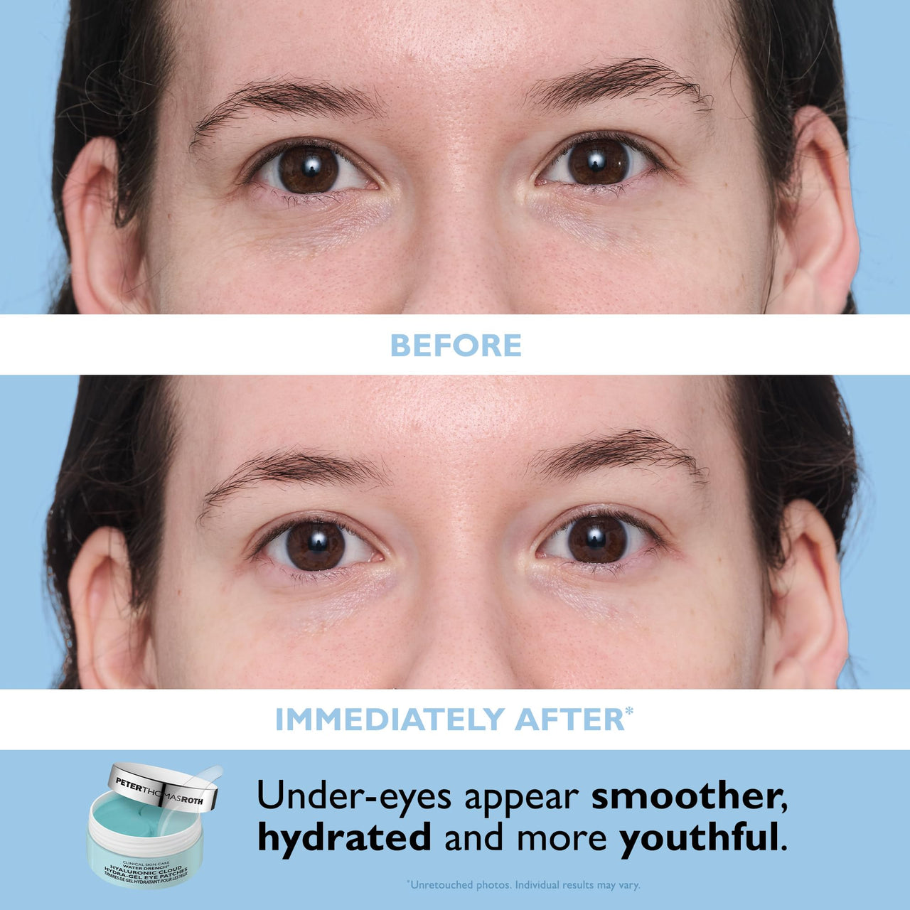 Peter Thomas Roth | Full-Size Vitamin C & Hyaluronic Eye Patches 2-Piece Kit