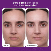 Thumbnail for Paula's Choice CLINICAL 1% Retinol Treatment Cream with Peptides, Vitamin C & Licorice Extract, Anti-Aging & Wrinkles, Travel Size. PACKAGING MAY VARY.
